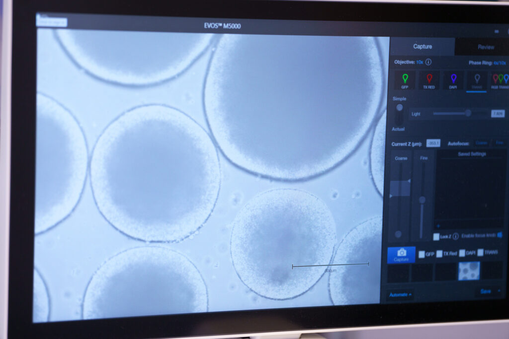 Photo of a lab screen with cells